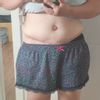 Côtés après abdominoplastie