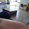 J'ai des cicatrices sur les bras