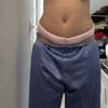 Poignées d’amour après abdominoplastie sans liposuccion