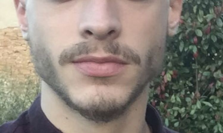 Peau jeune relâchée post hyaluronidase - 82833