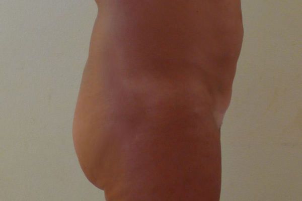 Volume fesses - 249