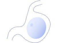 Allurion Ballon Gastrique