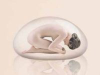 Prothèses mammaires Sebbin