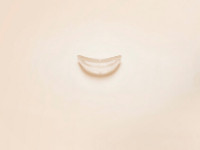 Implants faciaux Sebbin