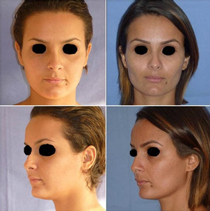 Comment choisir mon chirurgien ?