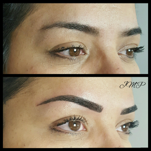 dermopigmentation avant apres