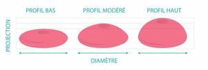 Projection des prothèses mammaires