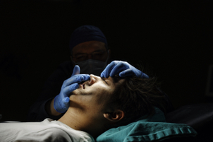 La procédure rhinoplastie secondaire
