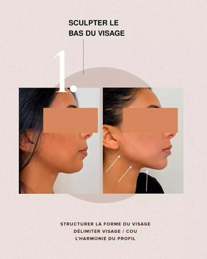 avant / après lifting