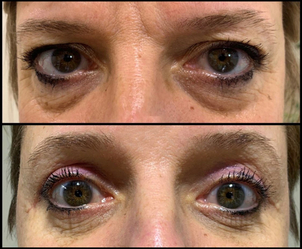 Comment choisir mon chirurgien ?