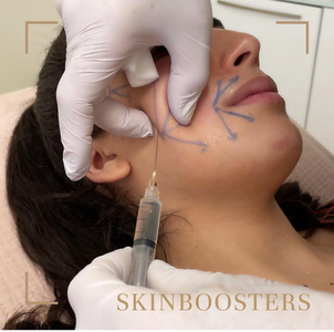 Skinboosters au visage