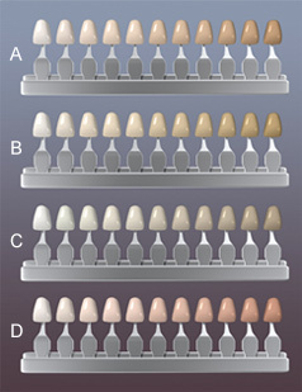 Blanchiment des dents - Teintes