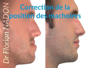 Chirurgie maxillo-faciale: expériences, médecins, photos, questions et ...