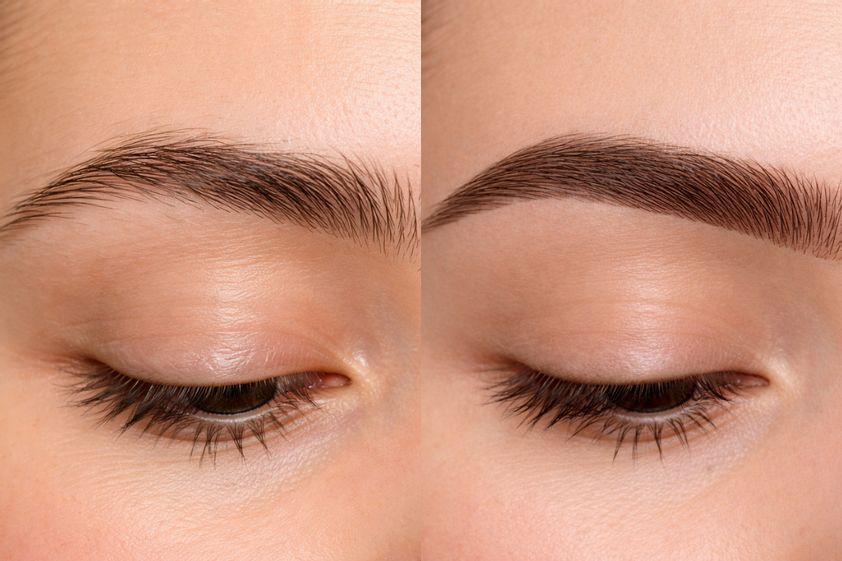 Dermopigmentation