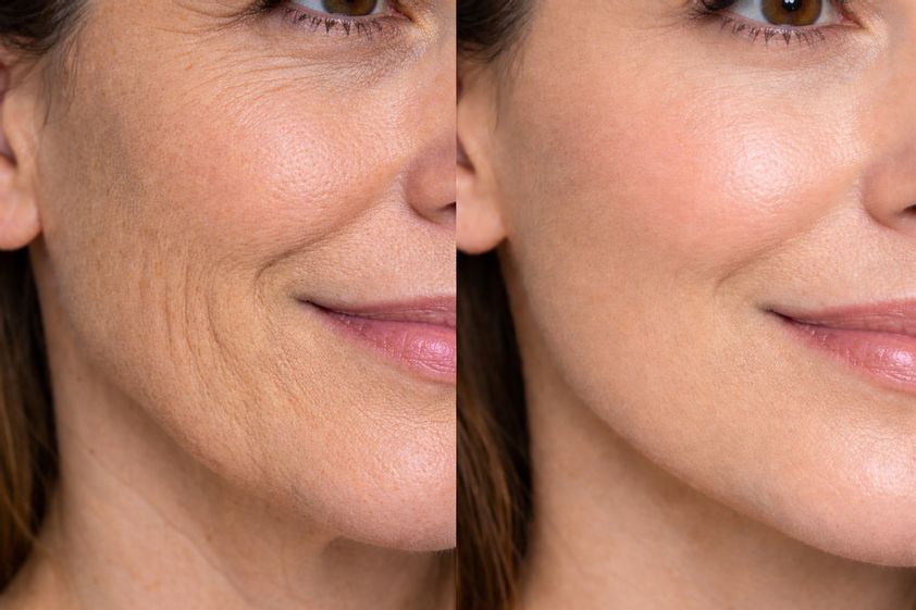 Skinbooster