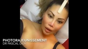 photorajeunissement