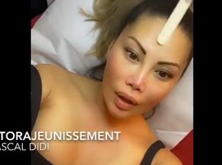 Photorajeunissement par lumière intense pulsée - Dr. Pascal Didi
