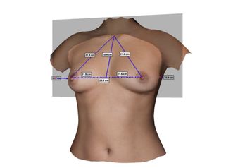 Crisalix Virtual Aesthetics Simulation for Dr. Roland Kolbe