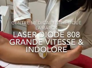 Épilation Laser Diode 808 nm très grande vitesse & indolore - Dr. Pascal Didi