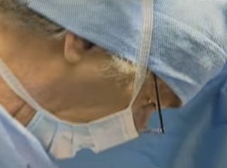 Comment se déroule une liposuccion du ventre ? 