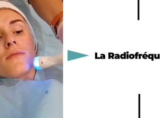 Radiofréquence Visage - Dr Catherine De Goursac