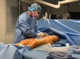 Body Remodelage : Lipoaspiration - Renuvion - Lipofilling
