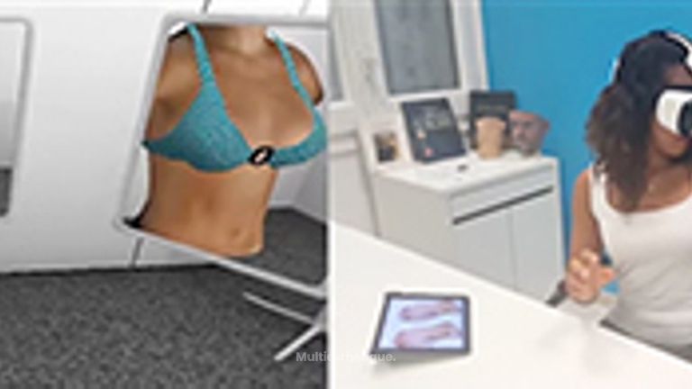 Simulation d'augmentation mammaire par 3D
