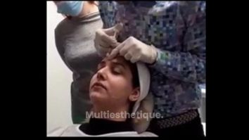 Rhinoplastie médicale - Dr Eugenio Broccaioli