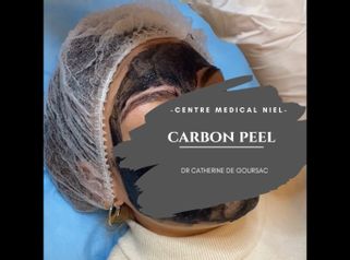 Carbon peel - Dr Catherine De Goursac