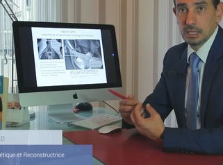 Qu'est-ce qu'une vaginoplastie?