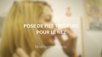 Pose de fils tenseurs pour le nez - Dr Catherine Eychenne - Esthetic Medicare Center