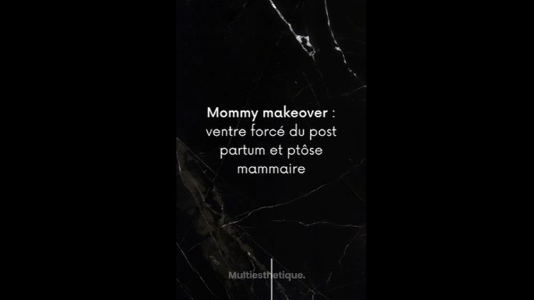 Mommy makeover - Dr Paul Seknadje