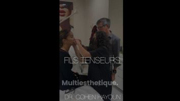 Fils tenseurs - Dr Éléonore Cohen-Hayoun