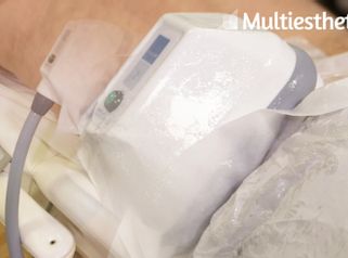 La cryolipolyse, quelle efficacité ?