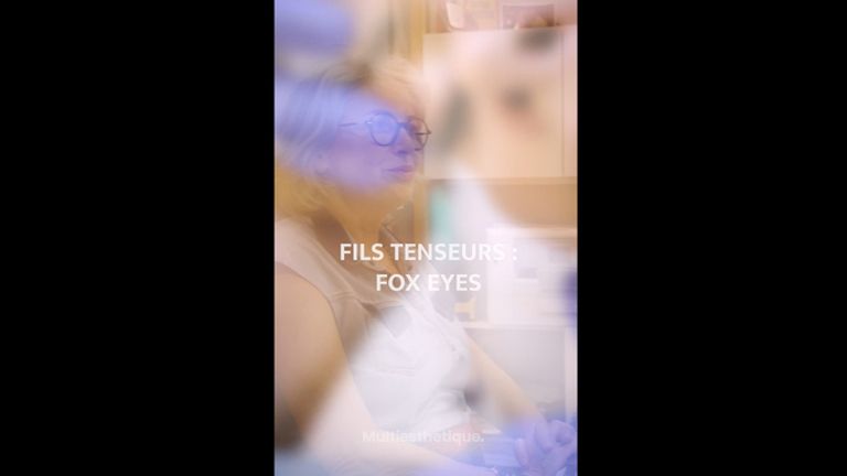 Foxy eyes - Dr Catherine Eychenne - Esthetic Medicare Center