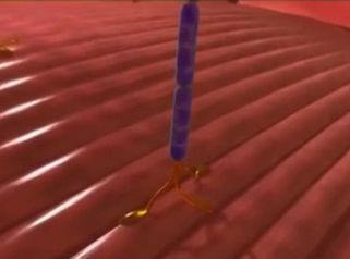 Pourquoi injecter le Botox dans le muscle ?