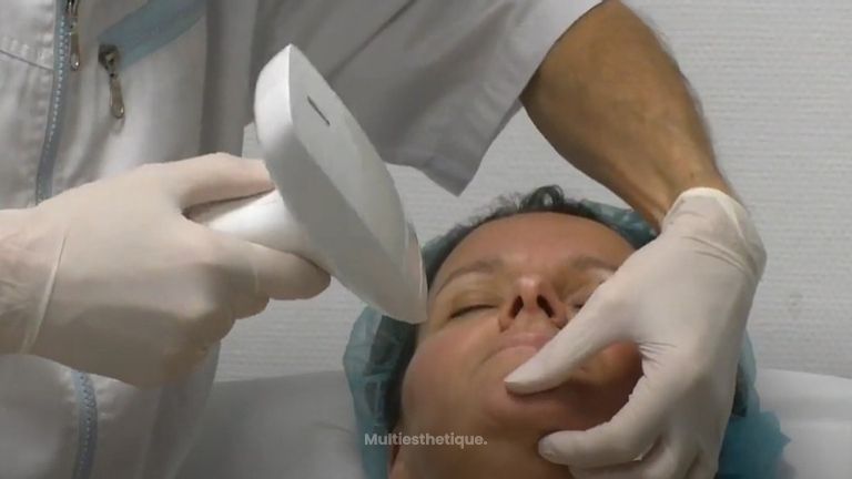 Radiofréquence nanofractionnée du visage et du corps au centre médical du Docteur Dubois à Angers