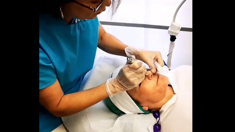 Microneedling - Dr Catherine Pannacci