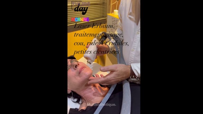 Laser erboium glass - Dr Eric Pietri