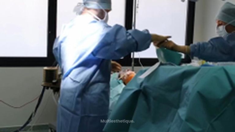 Augmentation mammaire - Dr Maxime Cowen