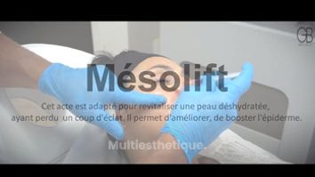 Mésolift