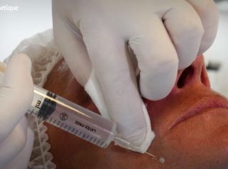 Les techniques de remaillage