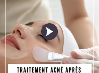 Traitment Acne Dr Catherine de Goursac