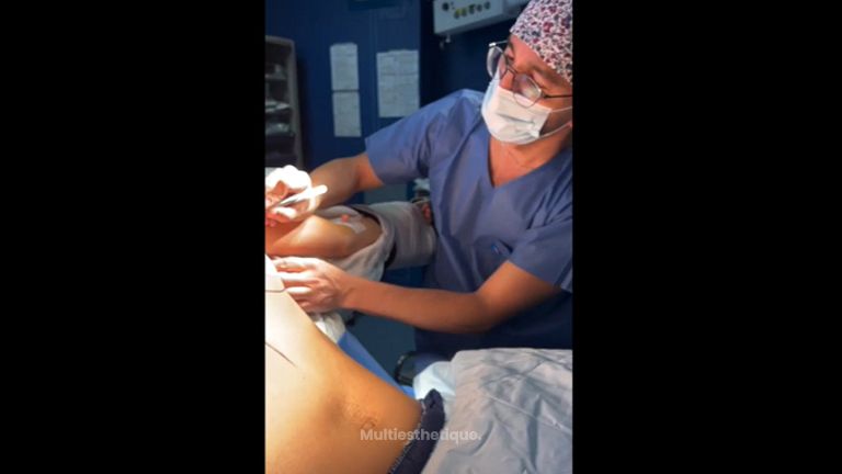 Augmentation mammaire - Dr Behzad Badie Modiri