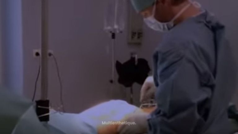 Le lipofilling pour augmenter la taille des mollets
