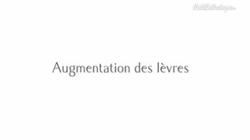 L'augmentation des lèvres au naturel