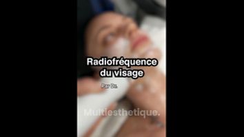 Radiofréquence du visage - Dr Catherine Eychenne - Esthetic Medicare Center