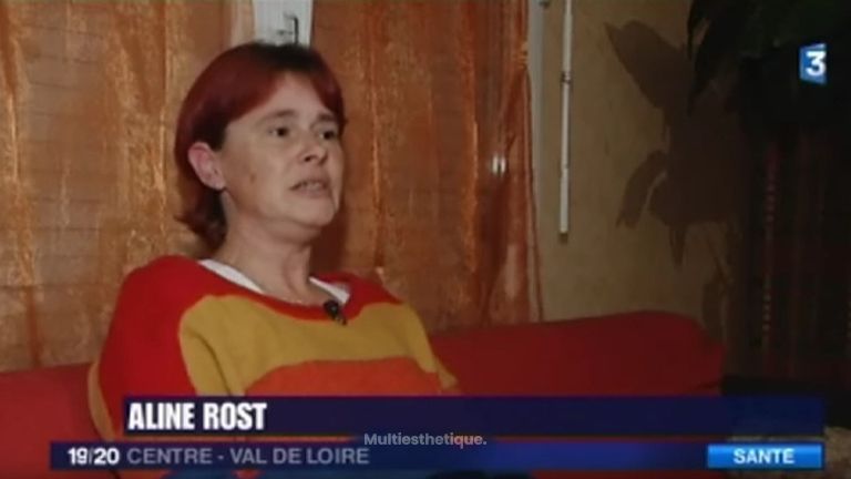 La reconstruction mammaire par DIEP - France 3