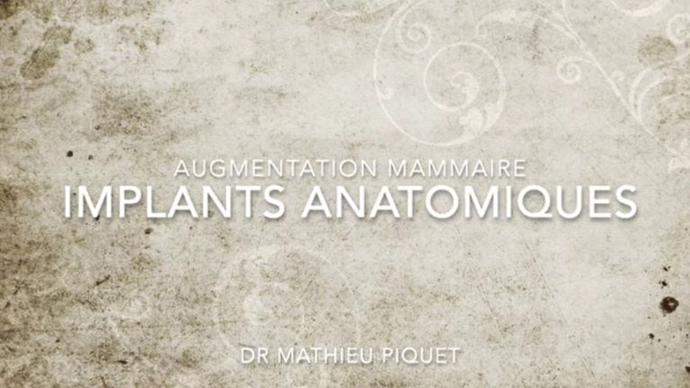 Augmentation mammaire - Dr Mathieu Piquet