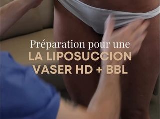 Liposuccion - Dr Maxime Cowen